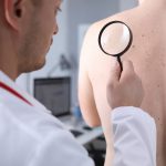 Cilt Kanseri İçin Tam Vücut Taraması: Neler Beklemelisiniz?