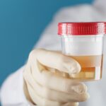 İdrar İçmenin Sağlığa Faydası Var mı? Kapsamlı Bir İnceleme