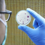 Koliform Bakteriler ve İçme Suyunda Arıtma Yöntemleri