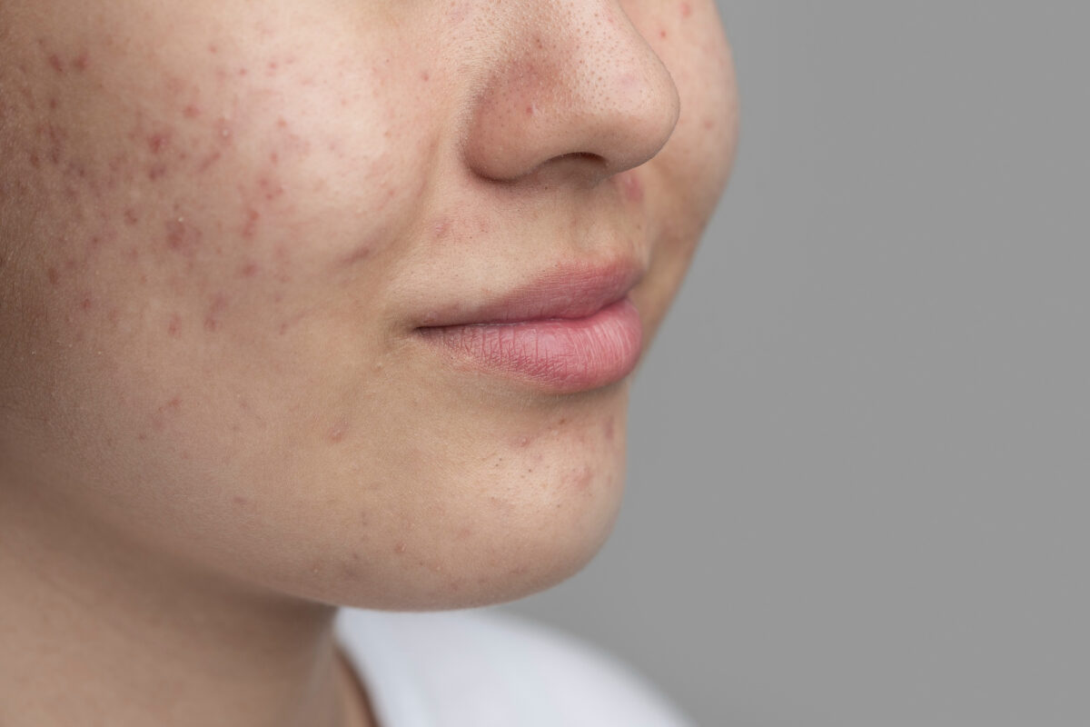 Yüksek Kortizol Seviyeleri ve Olası Nedenleri