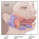 Tükürük Bezi Kanseri