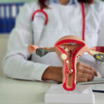 Adenomyozis: Rahim Duvarında Rahim İç Zarının Büyümesi