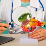 Akut Pankreatit - Belirtiler, Nedenler, Tedavi ve Önleme Yolları