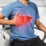 Alkolle İlişkili Karaciğer Hastalığı: Genel Bakış, Belirtiler, Nedenler, Teşhis, Tedavi ve Komplikasyonlar