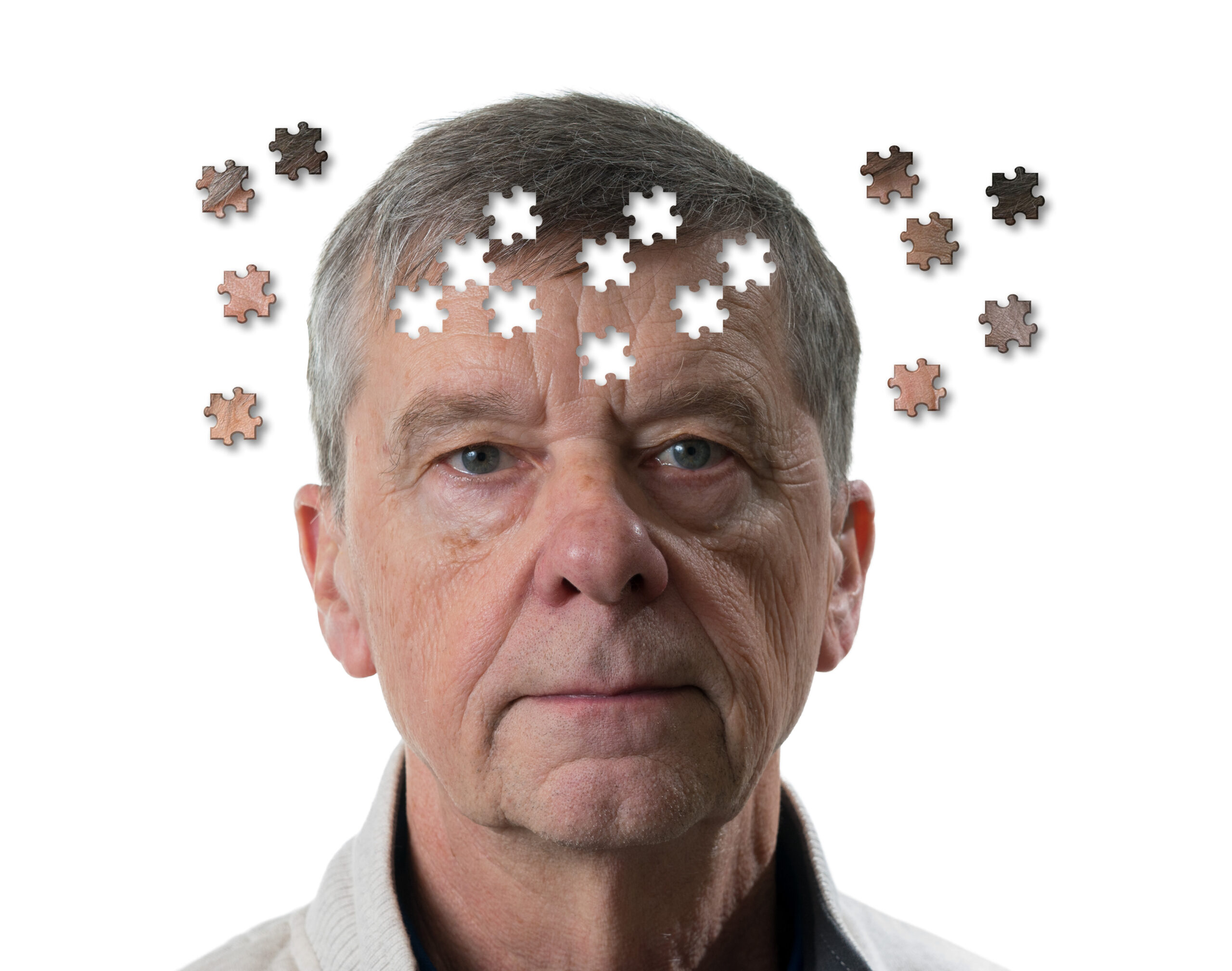 Alzheimer Hastalığı