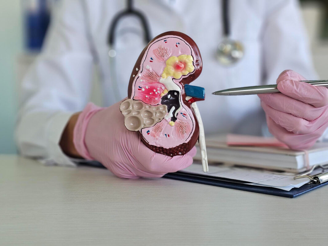 Kronik Böbrek Hastalığı Nedir?