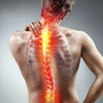 Ankilozan Spondilit (AS): Genel Bakış