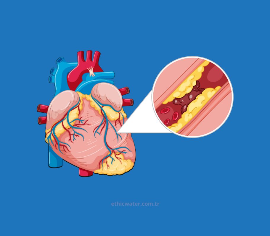 Ateroskleroz (Damar Sertliği)