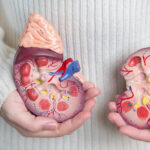 Kronik böbrek hastalığı: Belirtiler, nedenler ve tedavi yolları