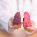 Akciğer Kanaması: Belirtiler, Nedenler ve Tedavi