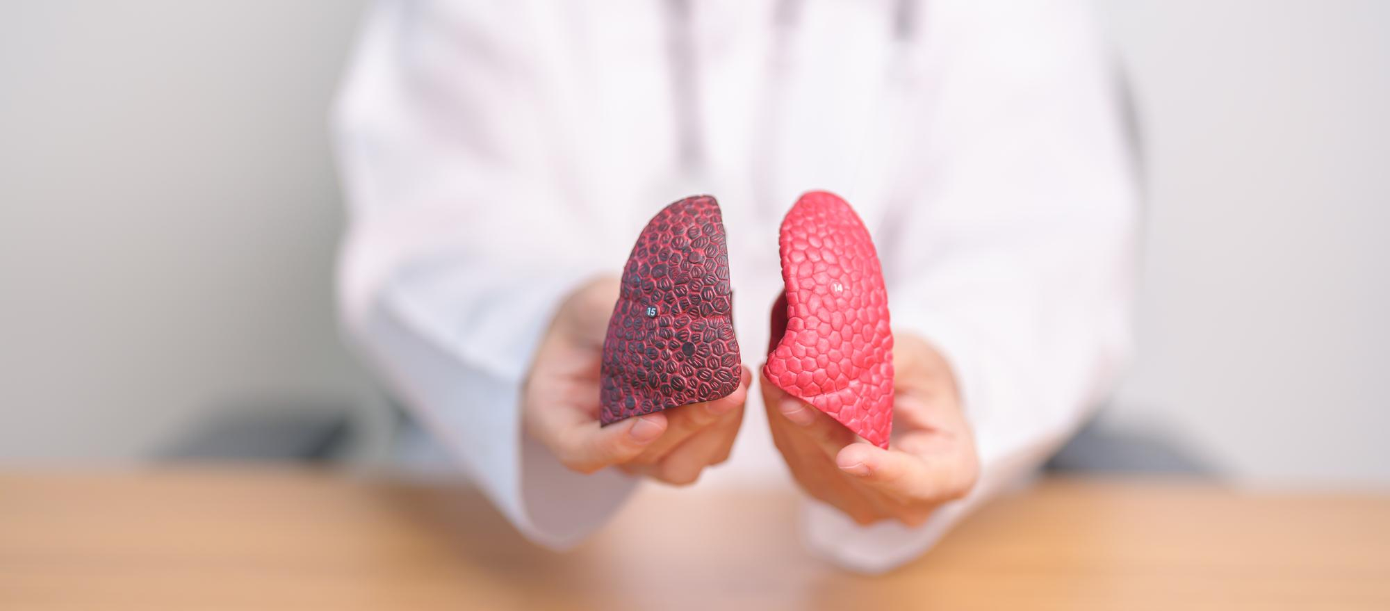 Akciğer Kanaması: Belirtiler, Nedenler ve Tedavi