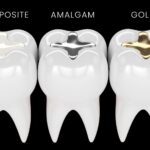 Amalgam Dolgu: Nedir, Zararları ve Güvenli Yaklaşım