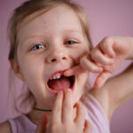 Süt Dişi Çürükleri: Çocukları Korumanın 5 Yolu