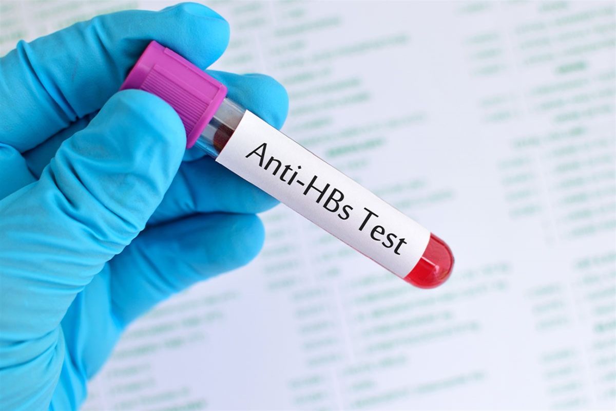 Anti HBs Nedir? Yüksekliği ve Düşüklüğü Ne Demek