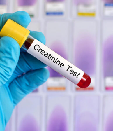 Kreatinin Nedir? Kreatinin Yüksekliği ve Düşüklüğü