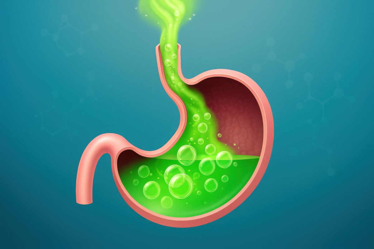 Mide Yanması Neden Olur, Mide Yanmasına Ne İyi Gelir?