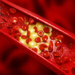 Trigliserid Yüksekliği ve Düşüklüğü Rehberi