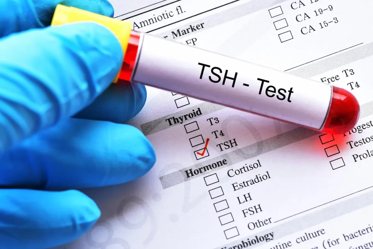 TSH Testi Nedir? Yüksekliği ve Düşüklüğü Ne Demek