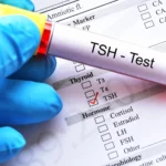 TSH Testi Nedir? Yüksekliği ve Düşüklüğü Ne Demek