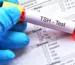 TSH Testi Nedir? Yüksekliği ve Düşüklüğü Ne Demek